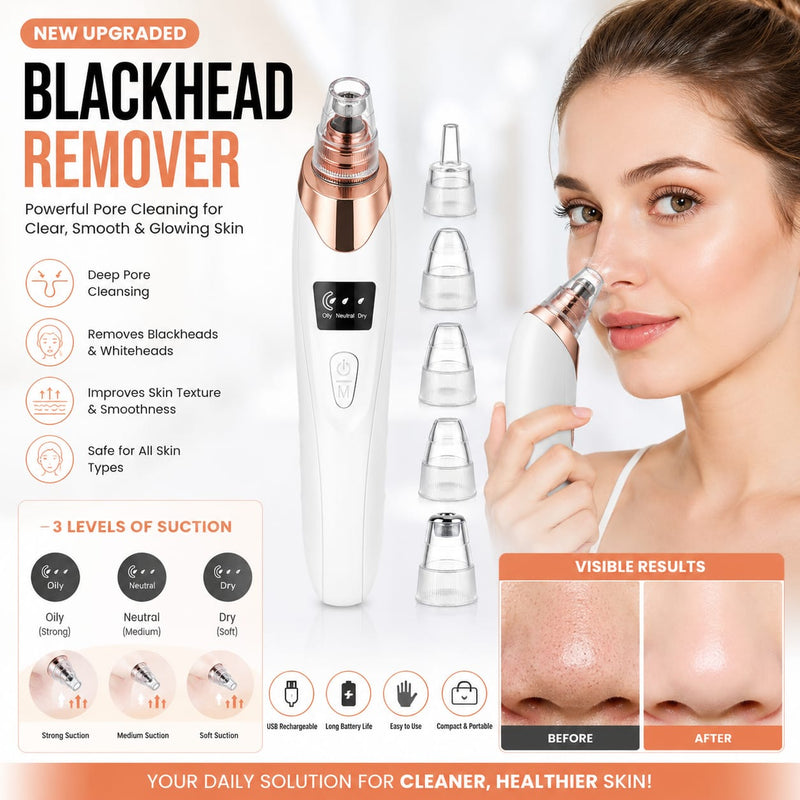 5-in-1 Rechargeable Blackhead Remover